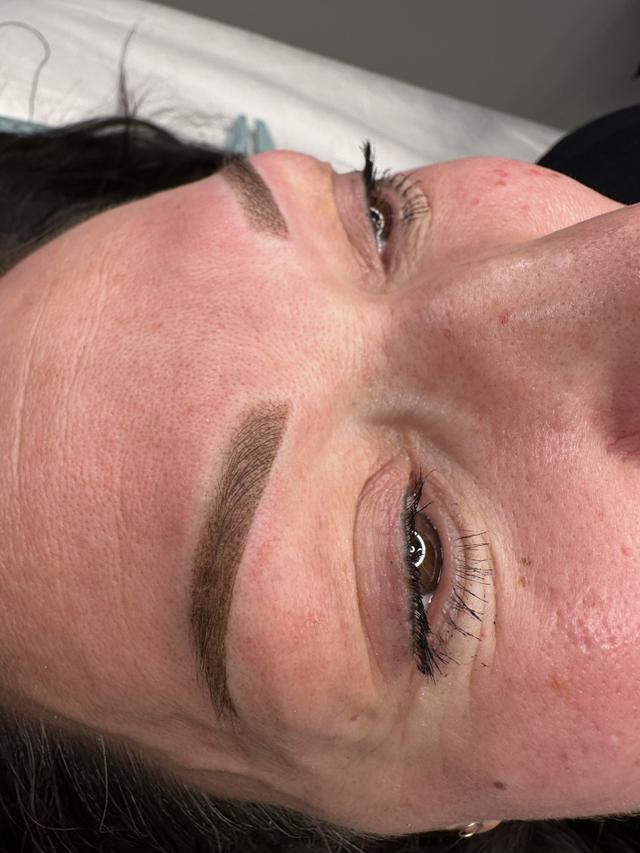 Browlifting Ergebnis 2