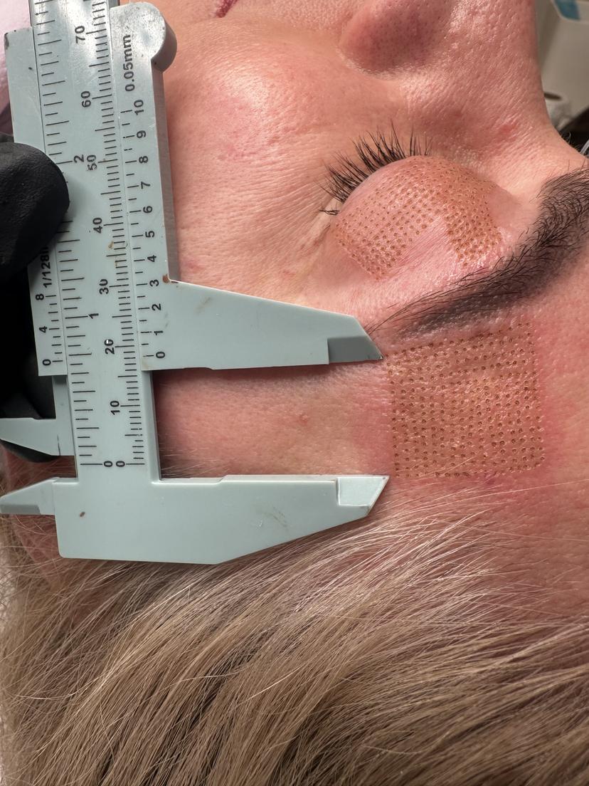 Sheen Berlin beauty treatment result - Professional microblading, lash lifting, and permanent makeup showcase 7