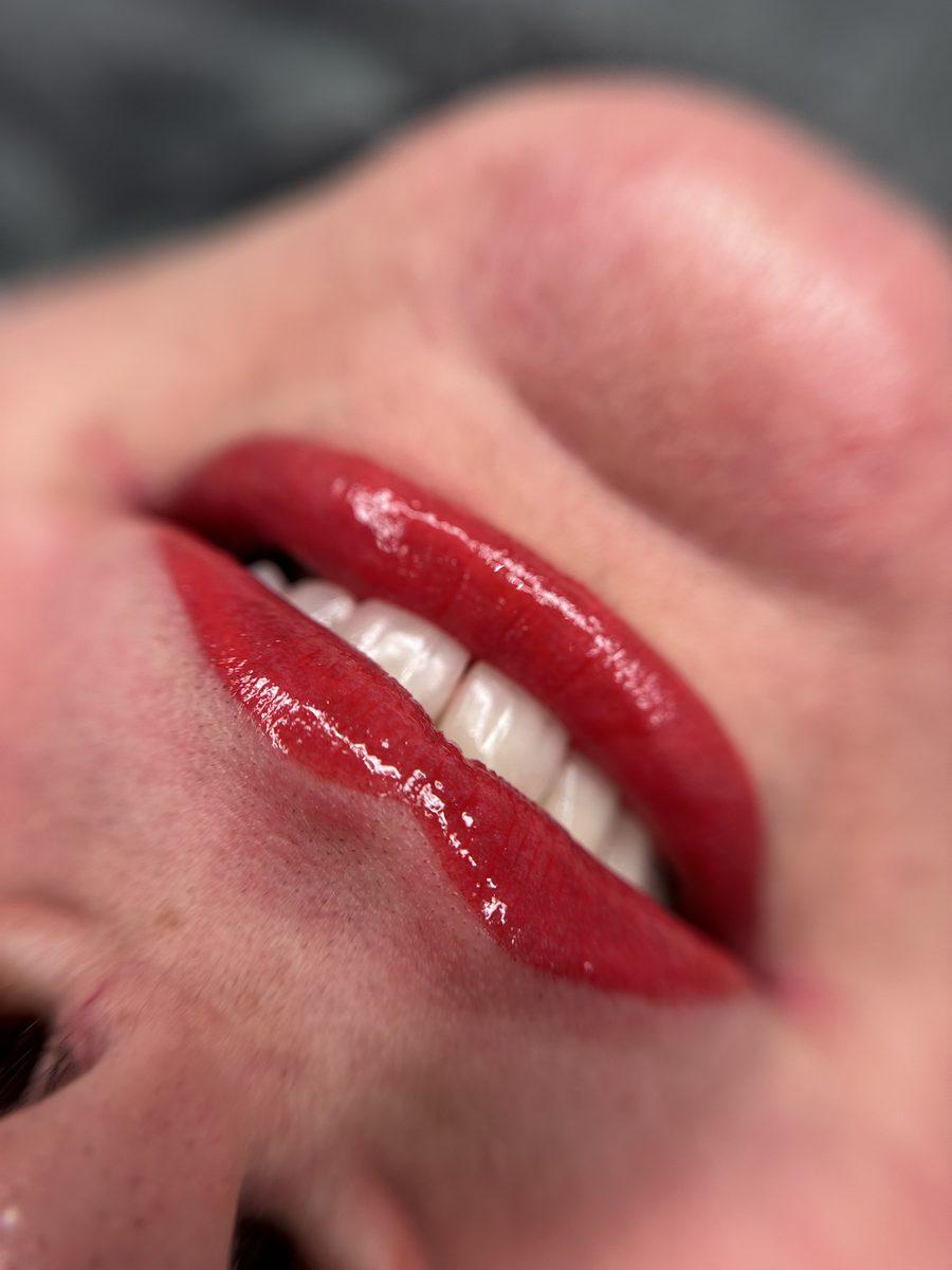 Lippen Ergebnis